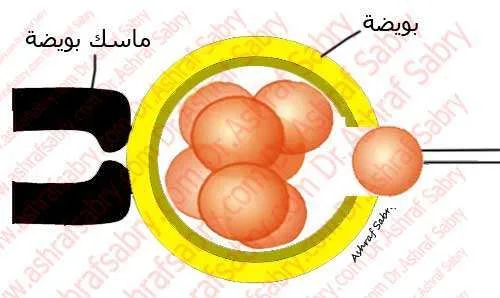 مساعدة تقشير الأجنة