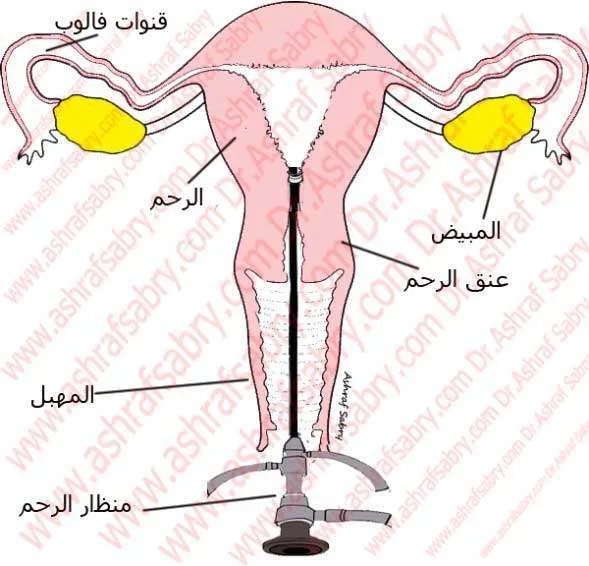 الفحص بالمنظار الرحمي و البطني لتشخيص تأخر الحمل