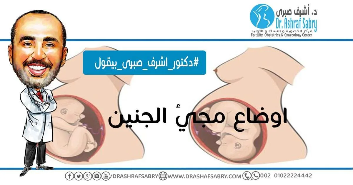 اوضاع-مجئ-الجنين
