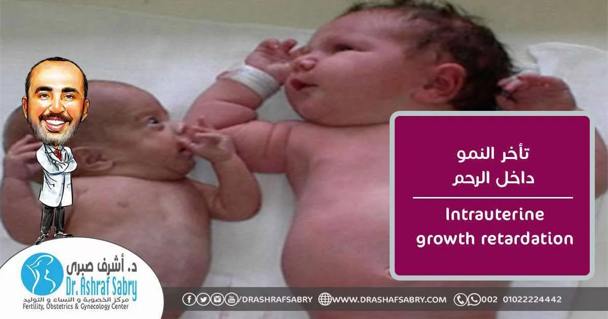 Intrauterine growth retardation