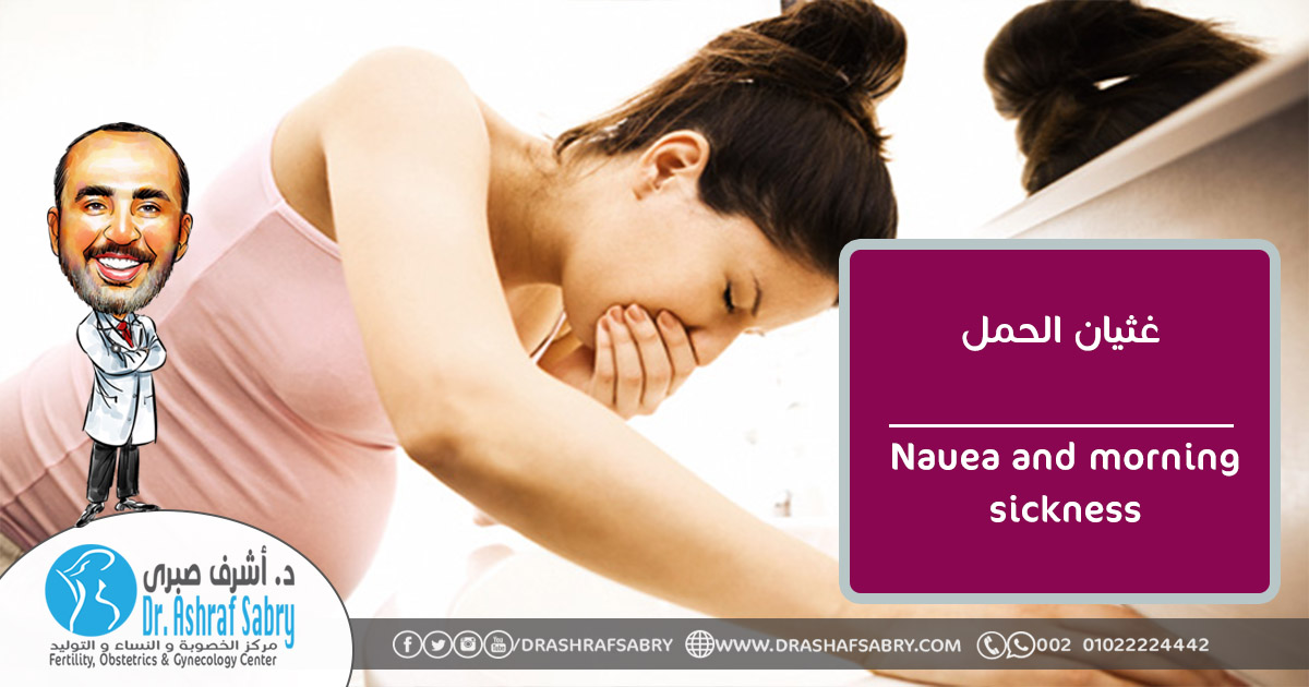Nausea and morning sickness غثيان الحمل
