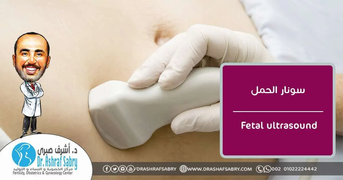 سونار الحمل
